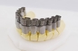 Stampante dentaria di Dual Fiber Laser Digital 20-60μM Crowns And Dentures 3D della stampante del FCC 3D