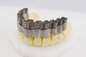 Singola industria di For Dental Jewelry della stampante del metallo del laser 3D della fibra