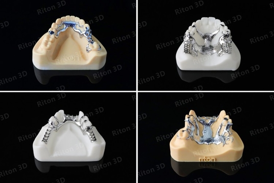 Nessun apparecchiature di stampa dentarie di Digital 3D del laboratorio di Industrial 500W della stampante del metallo 3D del laser di vibrazione