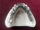 Stampa di titanio dentaria di One Stop Denture della stampante 3D della lega del cromo del cobalto