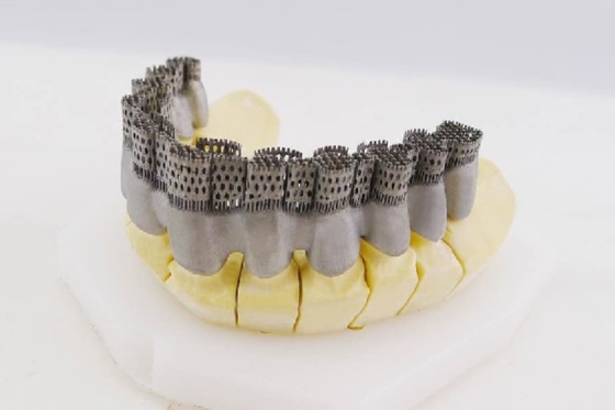 Stampatore Special Printing Equipment di Riton Dental 3D per la corona interna fusa ceramica del metallo